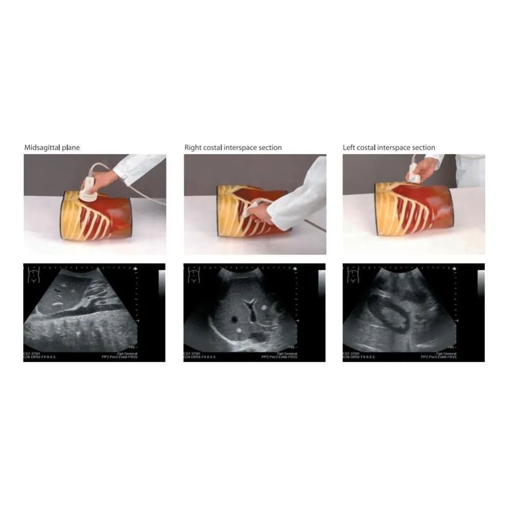 Ultrasound Exam 'ABDFAN' With Pathologies