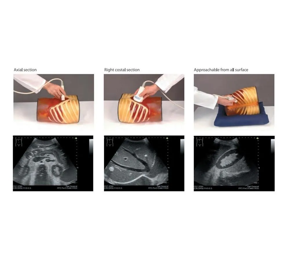 Ultrasound Exam 'ABDFAN' With Pathologies