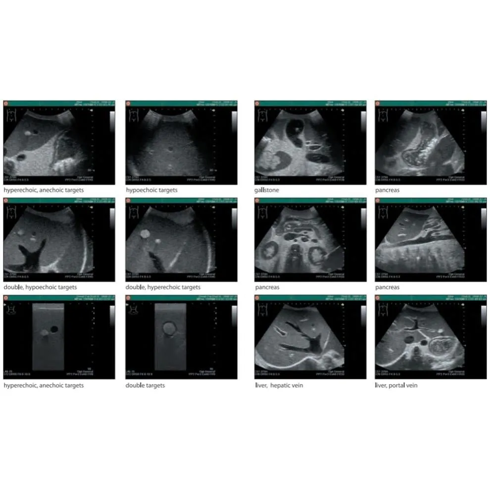 Ultrasound Exam 'ABDFAN' With Pathologies